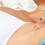 Botox® for Underarms