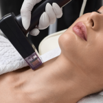 Dermapен® Microneedling