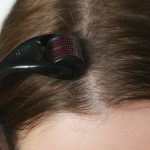 Dermapен® Microneedling