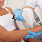 Laser Pigmented Scar